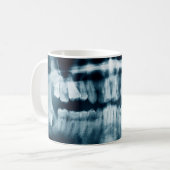 Mug Rayon X des dents (Devant gauche)