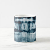 Mug Rayon X des dents (Centre)