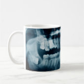 Mug Rayon X des dents (Gauche)
