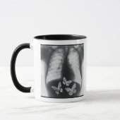 Mug Rayon X des papillons dans l'estomac (Gauche)