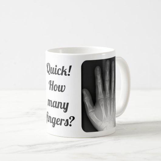 Mug Rayon X Polydactyl de main (Devant droit)