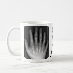 Mug Rayon X Polydactyl de main