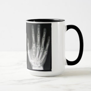 Mug Reine dans le rayon X de main