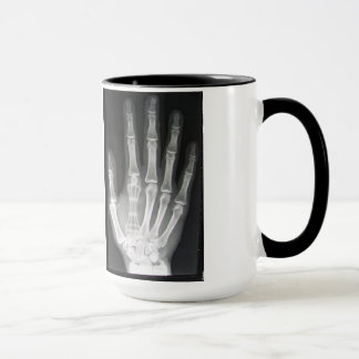 Mug Reine dans le rayon X de main