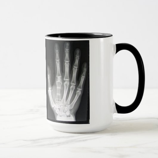 Mug Reine dans le rayon X de main (Droite)