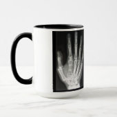 Mug Reine dans le rayon X de main (Gauche)