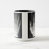 Mug Reine dans le rayon X de main (Centre)