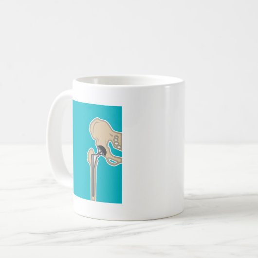 Mug Remplacement d'articulation de la hanche (Devant gauche)