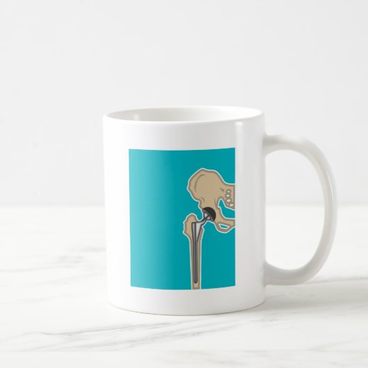 Mug Remplacement d'articulation de la hanche (Droite)