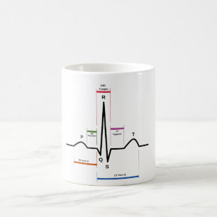 MUG Sinus Rhythm Électrocardiogramme ECG Diagramm