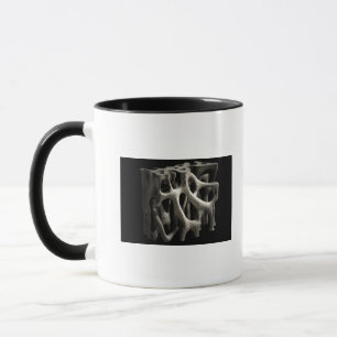 Mug Structure d'un os avec l'ostéoporose