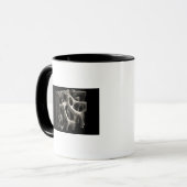 Mug Structure d'un os avec l'ostéoporose (Devant gauche)