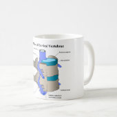 Mug Vertèbre cervicale de la colonne vertébrale (Devant droit)