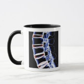 Mug Vertèbres lombaires 2 (Gauche)