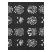 Nappe Analyse IRM du cerveau (Devant)