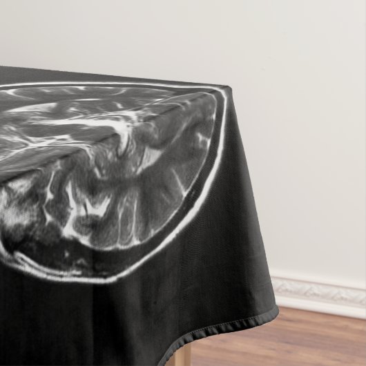 Nappe Analyse IRM du cerveau (In Situ)