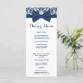 Navy Blue & White Lace Bow Slim Dinner Menu (Staand voorkant)
