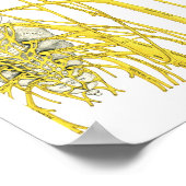 Nerfs épineux et subbluxes Poster chiropratique (Coin)