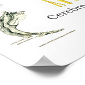 Nerfs épineux et subbluxes Poster chiropratique (Coin)