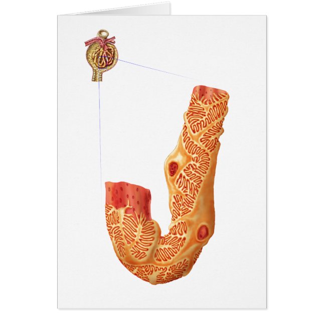 Nierbeschadiging en het filtratiemembraan (Voorkant)