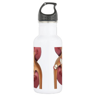 nieren waterfles 