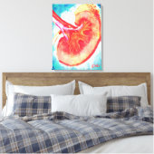 Nierinfectie Canvas Afdruk (Insitu (Slaapkamer))