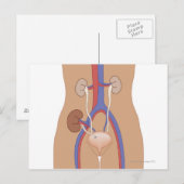 Niertransplantatie Briefkaart (Voorkant / Achterkant)