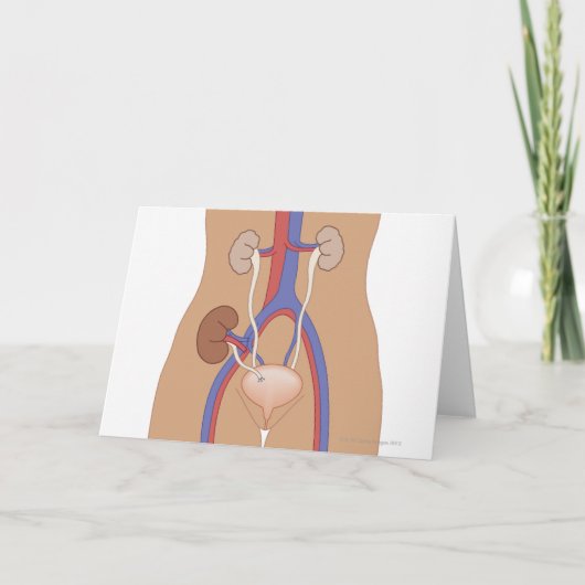 Niertransplantatie Kaart (Voorkant)