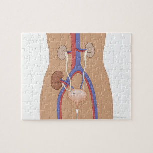 Niertransplantatie Legpuzzel