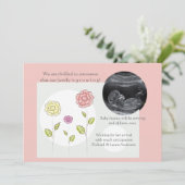 Nieuwe toevoeging Roze foto Zwangerschap Aankondig Aankondiging (Staand voorkant)