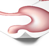 Nissen Poster de chirurgie de l'estomac de réplica (Coin)