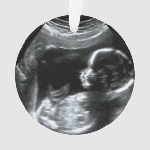 Noël Bébé Sonogramme Cadeau photo