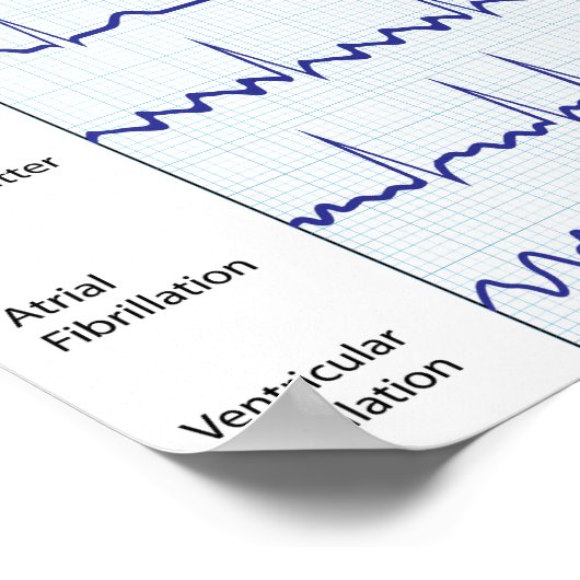 Normaal en pathologisch Poster (Hoek)