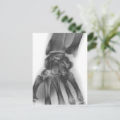 Normale pols, röntgenstraal briefkaart (Staand voorkant)