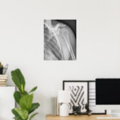 Normale schouder. Röntgenfoto van de gezonde linke Poster (Thuiskantoor)