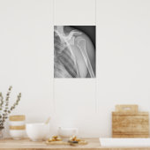 Normale schouder. Röntgenfoto van de gezonde linke Poster (Keuken)