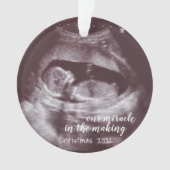 Notre Miracle Pour La Fabrication D'Ultrasons Sono (devant)