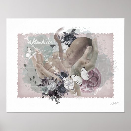 Obgyn Poster (Voorkant)