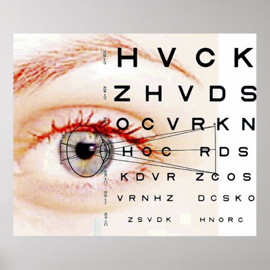 oftalmologie poster (Voorkant)