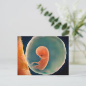 Ontwikkeling van de foetus op 9 weken briefkaart (Staand voorkant)