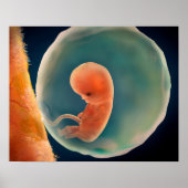 Ontwikkeling van de foetus op 9 weken poster (Voorkant)