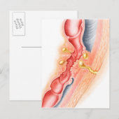 Ontwikkeling van fistels briefkaart (Voorkant / Achterkant)