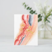 Ontwikkeling van fistels briefkaart (Staand voorkant)