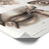 Oogchirurgie Anatomie Afdrukken Poster (Hoek)