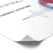 Oogdefect presbyopia Poster (Hoek)