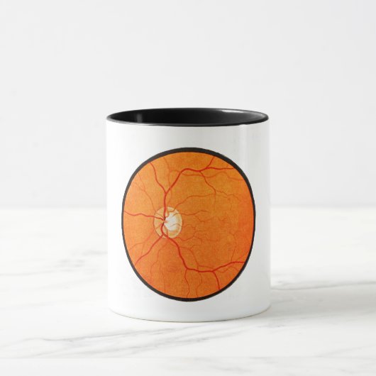 Ophtalmologie Optométrie Oeil Fundus Exode Mug (Centre)