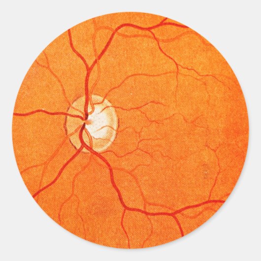 Ophtalmologie Optométrie OEil Fundus Stickers Exam (Devant)