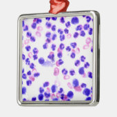 Ornement Carré Argenté Infection de staphylocoque (Gauche)