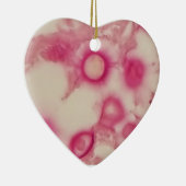 Ornement cryptococcal (Droite)