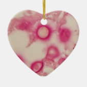 Ornement cryptococcal (Devant)